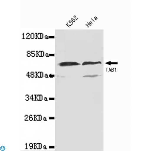 TAB1 Antibody - Western blot detection of TAB1 (N-term) in K562 and Hela lysates using TAB1 (N-term) mouse mAb (1:1000 diluted). Predicted band size: 55KDa. Observed band size: 55KDa.