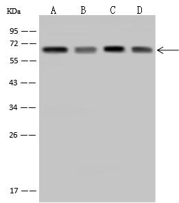 TAB1 Antibody - Anti-TAB1 rabbit polyclonal antibody at 1:500 dilution. Lane A: 293T Whole Cell Lysate. Lane B: A431 Whole Cell Lysate. Lane C: HeLa Whole Cell Lysate. Lane D: A375 Whole Cell Lysate. Lysates/proteins at 30 ug per lane. Secondary: Goat Anti-Rabbit IgG (H+L)/HRP at 1/10000 dilution. Developed using the ECL technique. Performed under reducing conditions. Predicted band size: 55 kDa.
