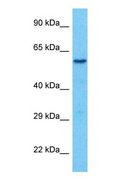 TAB2 Antibody - Western blot of TAB2 Antibody with human 786-0 Whole Cell lysate.  This image was taken for the unconjugated form of this product. Other forms have not been tested.