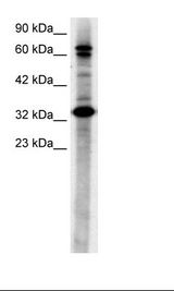 TAB2 Antibody - HepG2 Cell Lysate.  This image was taken for the unconjugated form of this product. Other forms have not been tested.