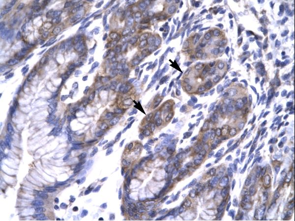 TAB2 Antibody - TAB2 antibody ARP32402_P050-NP_055908-MAP3K7IP2 (mitogen-activated protein kinase kinase kinase 7 interacting protein 2) Antibody was used in IHC to stain formalin-fixed, paraffin-embedded human stomach.  This image was taken for the unconjugated form of this product. Other forms have not been tested.