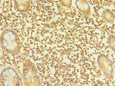 TAC1  Antibody - Immunohistochemistry of paraffin-embedded human small intestine using antibody 1:100 dilution.