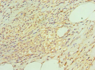 TAC1  Antibody - Immunohistochemistry of paraffin-embedded human epityphlon tissue using TAC1 Antibody at dilution of 1:100