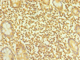 TAC1  Antibody - Immunohistochemistry of paraffin-embedded human small intestine tissue using TAC1 Antibody at dilution of 1:100