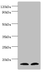 TAC1  Antibody - Western blot All lanes: Protachykinin-1 antibody at 6µg/ml Lane 1: Mouse liver tissue Lane 2: 293T whole cell lysate Secondary Goat polyclonal to rabbit IgG at 1/10000 dilution Predicted band size: 16, 14, 12 kDa Observed band size: 16 kDa