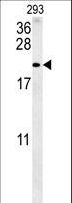 TAC1  Antibody - TAC1 Antibody western blot of 293 cell line lysates (35 ug/lane). The TAC1 antibody detected the TAC1 protein (arrow).