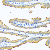 TAC1  Antibody - Immunohistochemistry of paraffin-embedded human prostate.