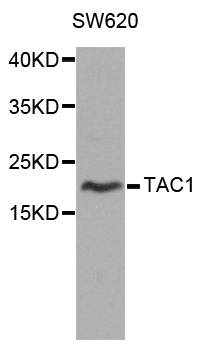 TAC1  Antibody - Western blot analysis of extracts of SW620 cells, using TAC1 antibody at 1:1000 dilution. The secondary antibody used was an HRP Goat Anti-Rabbit IgG (H+L) at 1:10000 dilution. Lysates were loaded 25ug per lane and 3% nonfat dry milk in TBST was used for blocking. An ECL Kit was used for detection and the exposure time was 90s.