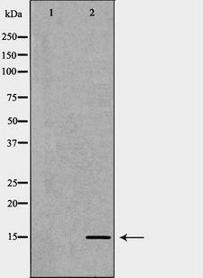 TAC1  Antibody - Western blot analysis of extracts of 293 cells using TAC1 antibody. The lane on the left is treated with the antigen-specific peptide.