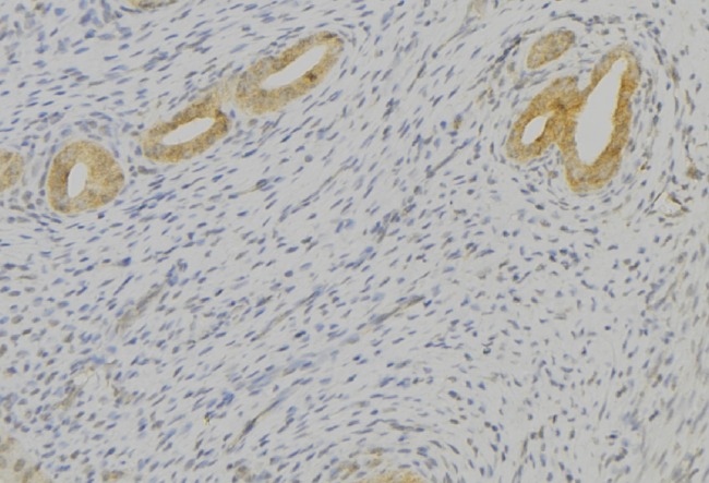 TAC1  Antibody - 1:100 staining human uterus tissue by IHC-P. The sample was formaldehyde fixed and a heat mediated antigen retrieval step in citrate buffer was performed. The sample was then blocked and incubated with the antibody for 1.5 hours at 22°C. An HRP conjugated goat anti-rabbit antibody was used as the secondary.