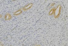 TAC1  Antibody - 1:100 staining human uterus tissue by IHC-P. The sample was formaldehyde fixed and a heat mediated antigen retrieval step in citrate buffer was performed. The sample was then blocked and incubated with the antibody for 1.5 hours at 22°C. An HRP conjugated goat anti-rabbit antibody was used as the secondary.