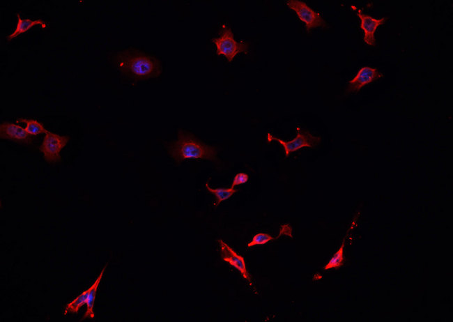 TAC1  Antibody - Staining HepG2 cells by IF/ICC. The samples were fixed with PFA and permeabilized in 0.1% Triton X-100, then blocked in 10% serum for 45 min at 25°C. The primary antibody was diluted at 1:200 and incubated with the sample for 1 hour at 37°C. An Alexa Fluor 594 conjugated goat anti-rabbit IgG (H+L) antibody, diluted at 1/600, was used as secondary antibody.