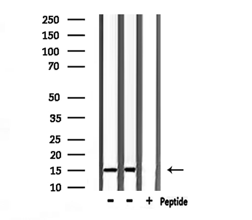 TAC1  Antibody - Western blot analysis of extracts of mouse liver, rat liver tissue using TAC1 antibody.