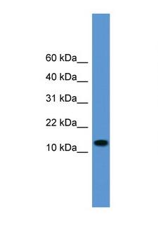TAC1  Antibody - TAC1 antibody Western blot of 721_B Cell lysate. Antibody concentration 1 ug/ml.  This image was taken for the unconjugated form of this product. Other forms have not been tested.