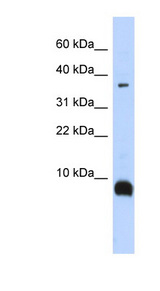 TAC3 / Tachykinin Antibody - TAC3 antibody Western blot of Fetal Brain lysate. This image was taken for the unconjugated form of this product. Other forms have not been tested.