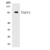 TACC1 Antibody - Western blot analysis of the lysates from HeLa cells using TACC1 antibody.
