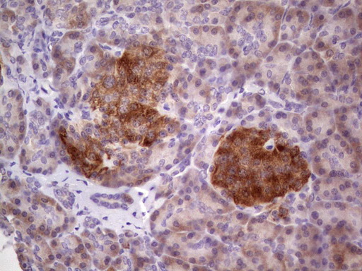 TACC1 Antibody - IHC of paraffin-embedded Human pancreas tissue using anti-TACC1 mouse monoclonal antibody. (Heat-induced epitope retrieval by 1 mM EDTA in 10mM Tris, pH8.5, 120°C for 3min).