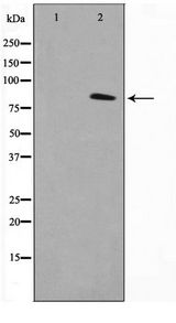 TACC1 Antibody - Western blot of K562 cell lysate using TACC1 Antibody