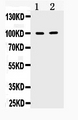 TACC1 Antibody - Western blot - Anti-TACC1 Picoband Antibody