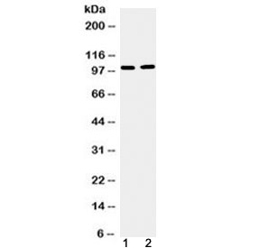 TACC1 Antibody - Western blot testing of 1) mouse testis and 2) human U87 cell lysate with TACC1 antibody at 0.5ug/ml. Predicted molecular weight ~88 kDa but routinely observed at 100-125 kDa.