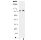 TACC1 Antibody - Western blot testing of 1) mouse testis and 2) human U87 cell lysate with TACC1 antibody at 0.5ug/ml. Predicted molecular weight ~88 kDa but routinely observed at 100-125 kDa.