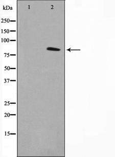 TACC1 Antibody - Western blot analysis on K562 cell lysates using TACC1 antibody. The lane on the left is treated with the antigen-specific peptide.