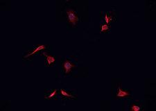 TACC1 Antibody - Staining K562 cells by IF/ICC. The samples were fixed with PFA and permeabilized in 0.1% Triton X-100, then blocked in 10% serum for 45 min at 25°C. The primary antibody was diluted at 1:200 and incubated with the sample for 1 hour at 37°C. An Alexa Fluor 594 conjugated goat anti-rabbit IgG (H+L) Ab, diluted at 1/600, was used as the secondary antibody.