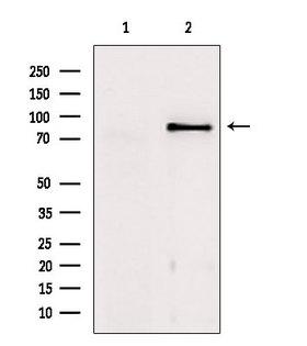 TACC1 Antibody - Western blot analysis of extracts of mouse brain tissue using TACC1 antibody. Lane 1 was treated with the blocking peptide.