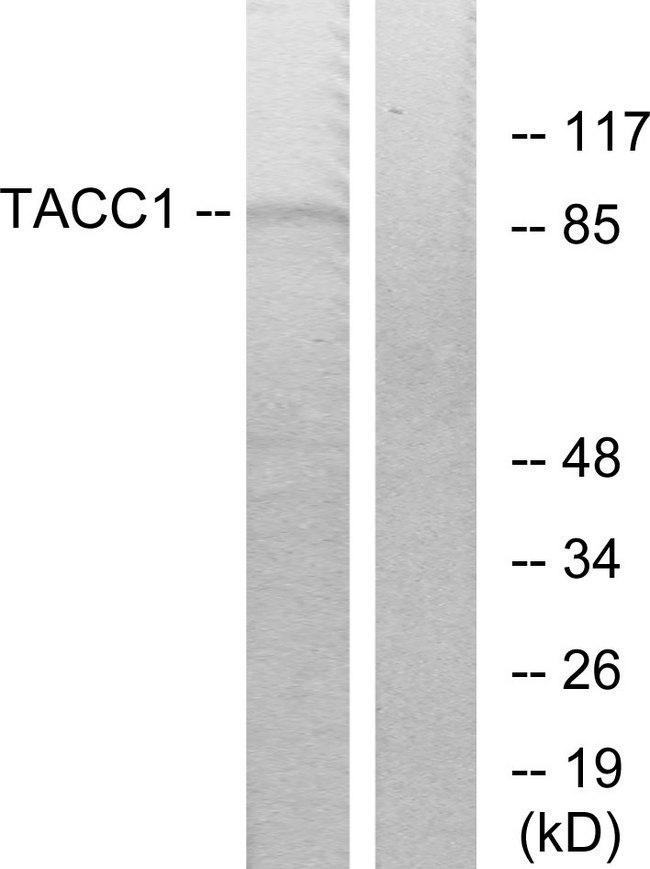 TACC1 Antibody - Western blot analysis of extracts from K562 cells, using TACC1 antibody.