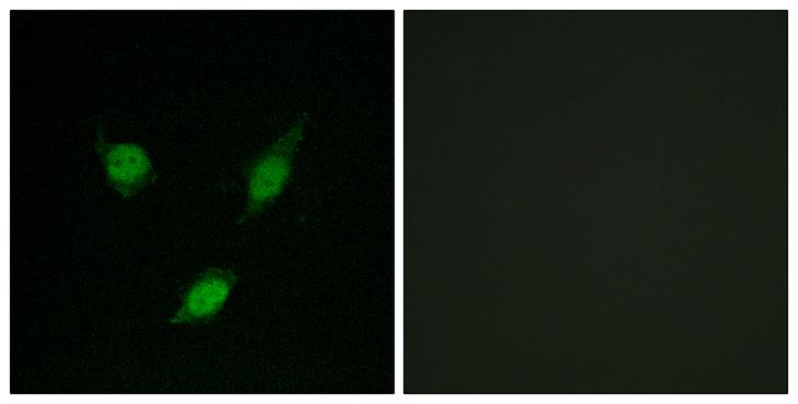 TACC1 Antibody - Peptide - + Immunofluorescence analysis of MCF-7 cells, using TACC1 antibody.