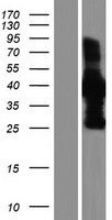 TACC1 Protein - Western validation with an anti-DDK antibody * L: Control HEK293 lysate R: Over-expression lysate