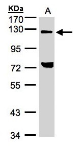 TACC2 Antibody - Sample (30 ug whole cell lysate). A: H1299. 7.5% SDS PAGE. TACC2 antibody diluted at 1:1000