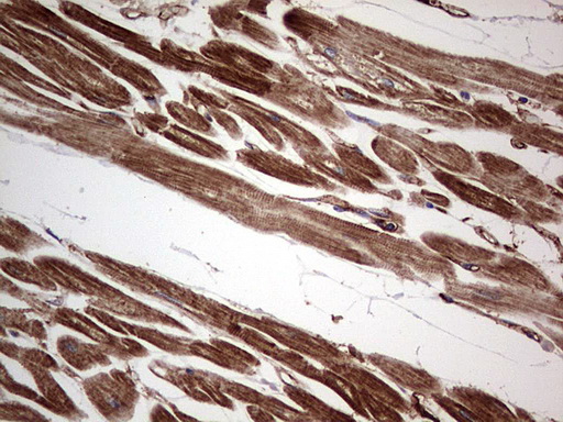 TACC2 Antibody - IHC of paraffin-embedded Human adult heart tissue using anti-TACC2 mouse monoclonal antibody. (Heat-induced epitope retrieval by 1 mM EDTA in 10mM Tris, pH8.5, 120°C for 3min).