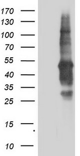 TACC2 Antibody - HEK293T cells were transfected with the pCMV6-ENTRY control. (Left lane) or pCMV6-ENTRY TACC2. (Right lane) cDNA for 48 hrs and lysed. Equivalent amounts of cell lysates. (5 ug per lane) were separated by SDS-PAGE and immunoblotted with anti-TACC2.