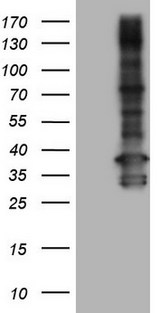 TACC2 Antibody - Human recombinant protein fragment corresponding to amino acids 727-1026 of human TACC2. (NP_008928) produced in E.coli.