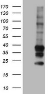 TACC2 Antibody - Human recombinant protein fragment corresponding to amino acids 727-1026 of human TACC2 (NP_008928) produced in E.coli.