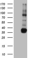 TACC2 Antibody - Human recombinant protein fragment corresponding to amino acids 727-1026 of human TACC2 (NP_008928) produced in E.coli.