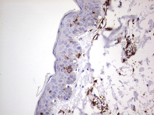 TACC2 Antibody - IHC of paraffin-embedded Human skin tissue using anti-TACC2 mouse monoclonal antibody. (Heat-induced epitope retrieval by 1 mM EDTA in 10mM Tris, pH8.5, 120°C for 3min).