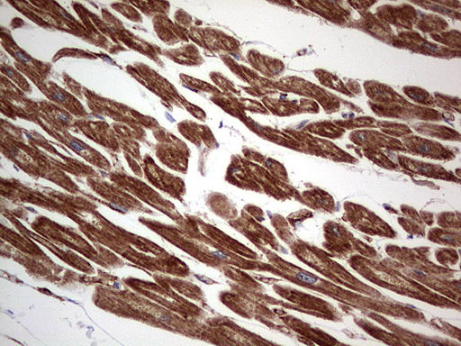 TACC2 Antibody - IHC of paraffin-embedded Human adult heart tissue using anti-TACC2 mouse monoclonal antibody. (Heat-induced epitope retrieval by 1 mM EDTA in 10mM Tris, pH8.5, 120°C for 3min).