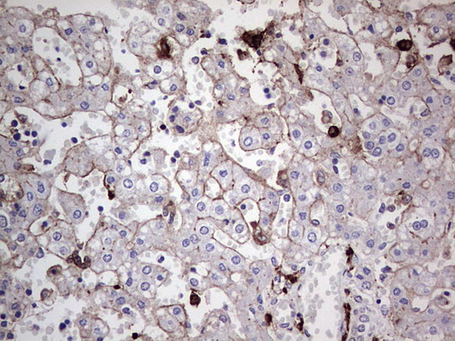 TACC2 Antibody - IHC of paraffin-embedded Human embryonic liver tissue using anti-TACC2 mouse monoclonal antibody. (Heat-induced epitope retrieval by 1 mM EDTA in 10mM Tris, pH8.5, 120°C for 3min).