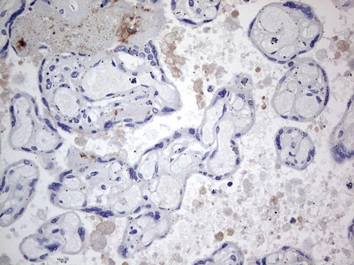 TACC2 Antibody - IHC of paraffin-embedded Human placenta tissue using anti-TACC2 mouse monoclonal antibody. (Heat-induced epitope retrieval by 1 mM EDTA in 10mM Tris, pH8.5, 120°C for 3min).
