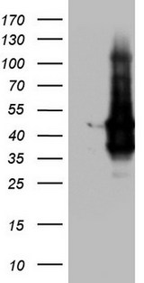 TACC2 Antibody - HEK293T cells were transfected with the pCMV6-ENTRY control (Left lane) or pCMV6-ENTRY TACC2 (Right lane) cDNA for 48 hrs and lysed. Equivalent amounts of cell lysates (5 ug per lane) were separated by SDS-PAGE and immunoblotted with anti-TACC2.