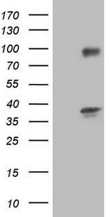 TACC2 Antibody - Human recombinant protein fragment corresponding to amino acids 727-1026 of human TACC2. (NP_008928) produced in E.coli.