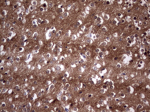TACC2 Antibody - IHC of paraffin-embedded Human embryonic brain cortex tissue using anti-TACC2 mouse monoclonal antibody. (Heat-induced epitope retrieval by 1 mM EDTA in 10mM Tris, pH8.5, 120°C for 3min).