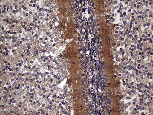 TACC2 Antibody - IHC of paraffin-embedded Human embryonic cerebellum using anti-TACC2 mouse monoclonal antibody. (Heat-induced epitope retrieval by 1 mM EDTA in 10mM Tris, pH8.5, 120°C for 3min).