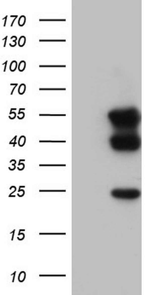 TACC2 Antibody - Human recombinant protein fragment corresponding to amino acids 727-1026 of human TACC2. (NP_008928) produced in E.coli. (1:500)