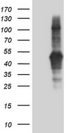 TACC2 Antibody - HEK293T cells were transfected with the pCMV6-ENTRY control (Left lane) or pCMV6-ENTRY TACC2 (Right lane) cDNA for 48 hrs and lysed. Equivalent amounts of cell lysates (5 ug per lane) were separated by SDS-PAGE and immunoblotted with anti-TACC2.