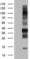 TACC2 Antibody - Human recombinant protein fragment corresponding to amino acids 727-1026 of human TACC2. (NP_008928) produced in E.coli.