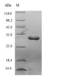 Limulus clotting factor C Protein - (Tris-Glycine gel) Discontinuous SDS-PAGE (reduced) with 5% enrichment gel and 15% separation gel.