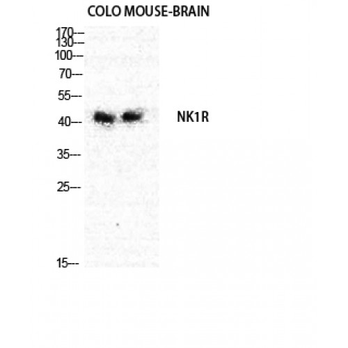 TACR1 / NK1R Antibody - Western blot of NK-1R antibody